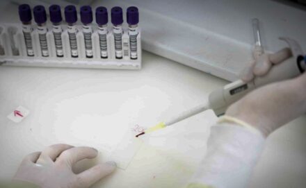 Ribercon - Paciente em SP com suspeita de ebola testa positivo para meningite